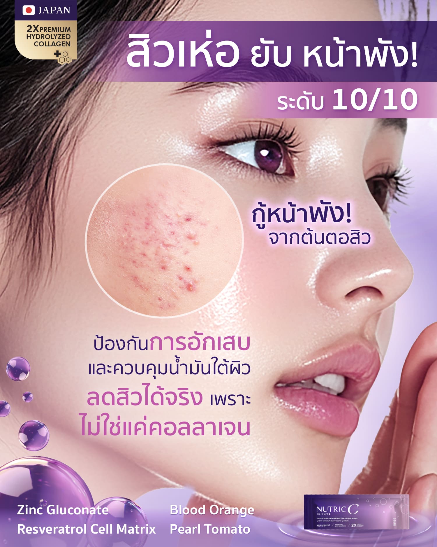 c สิวเห่อ ยับ